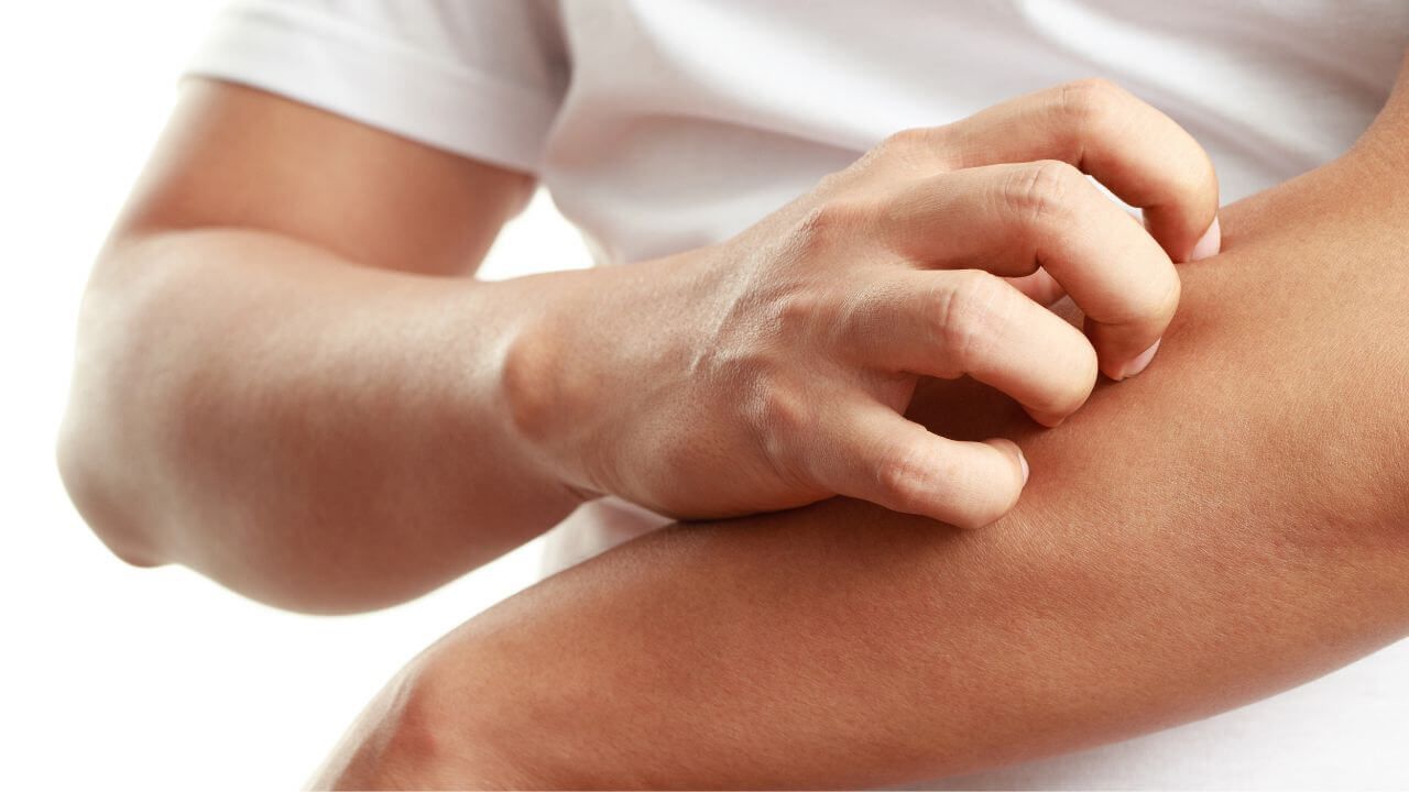 Best Body Wash for Psoriasis