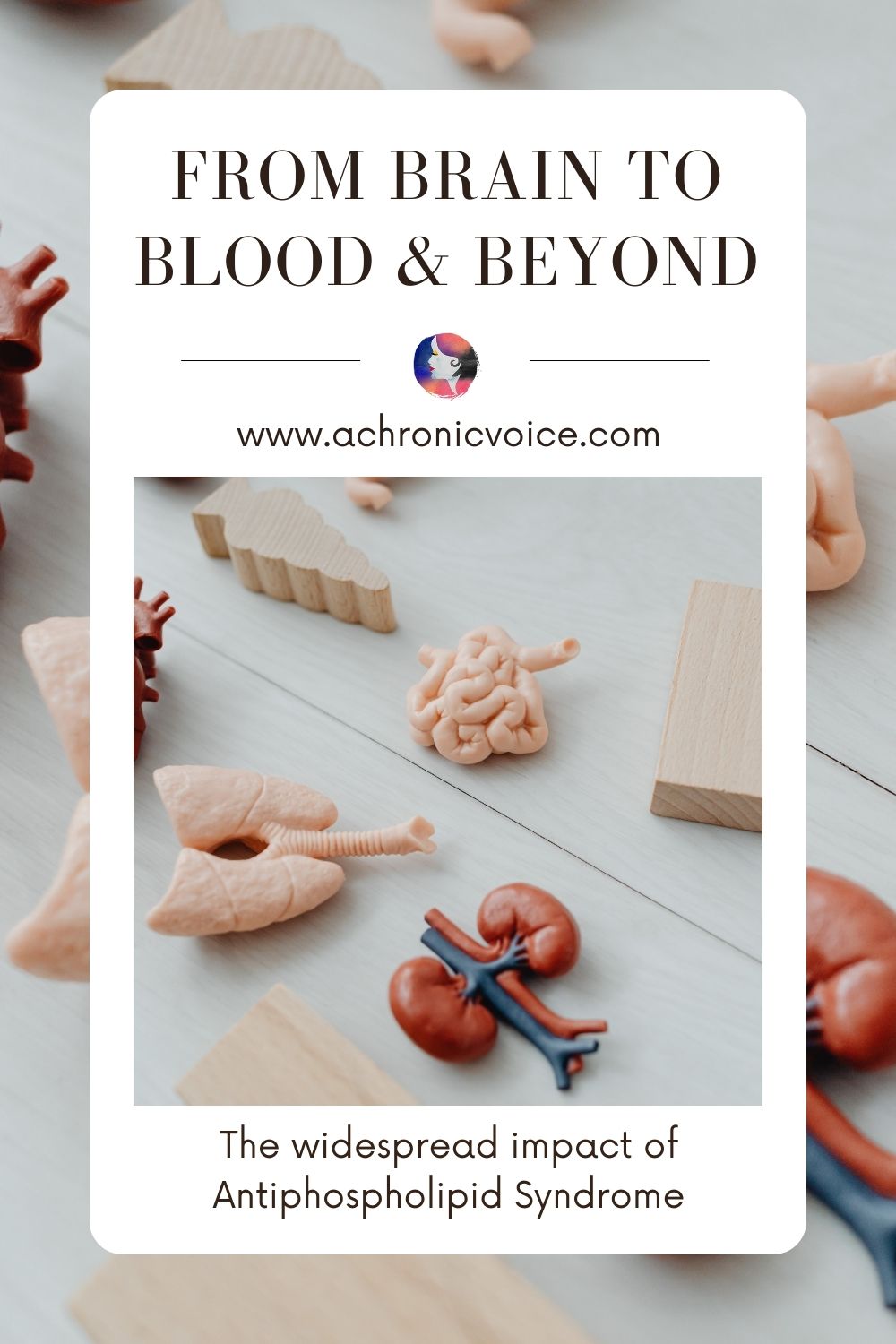 From Brain to Blood and Beyond - The widespread impact of Antiphospholipid Syndrome