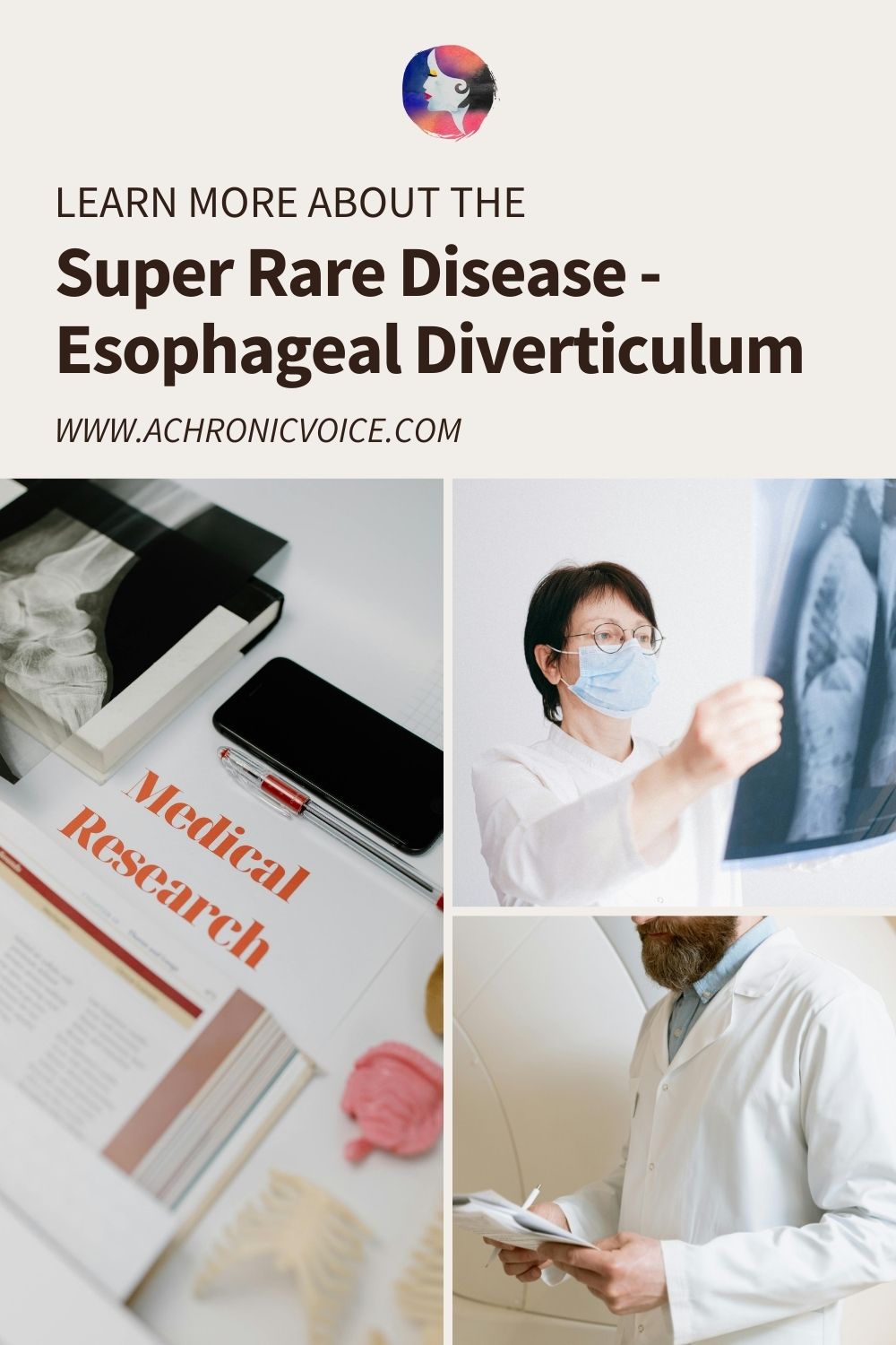 Learn About the Super Rare Disease - Esophageal Diverticulum