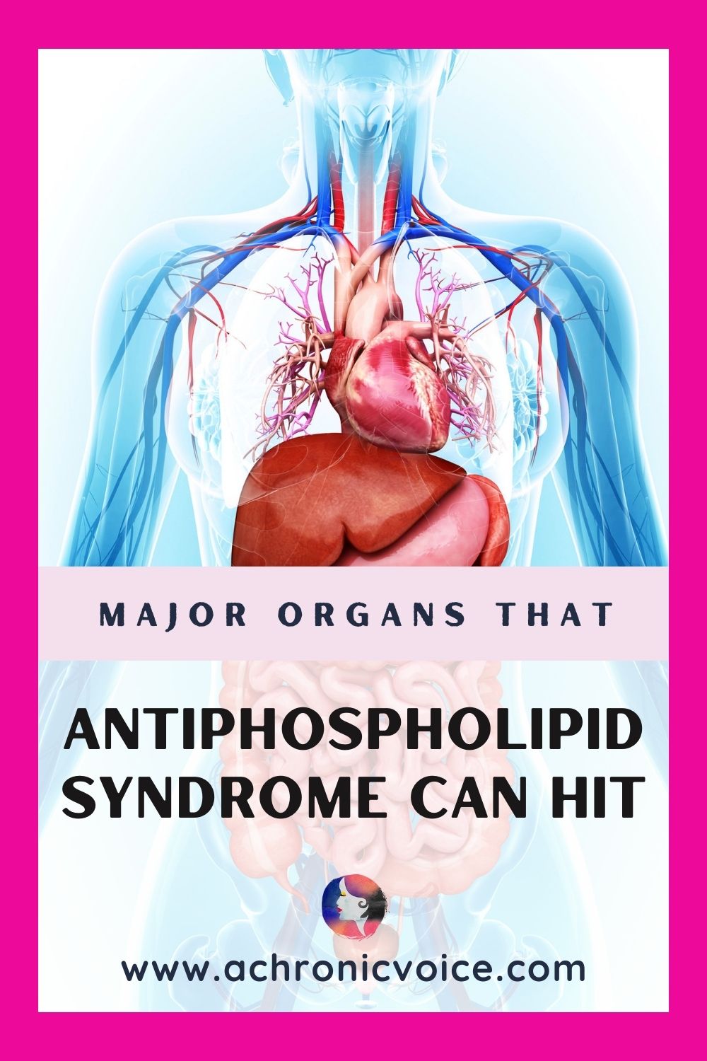 Major Organs that Antiphospholipid Syndrome Can Hit