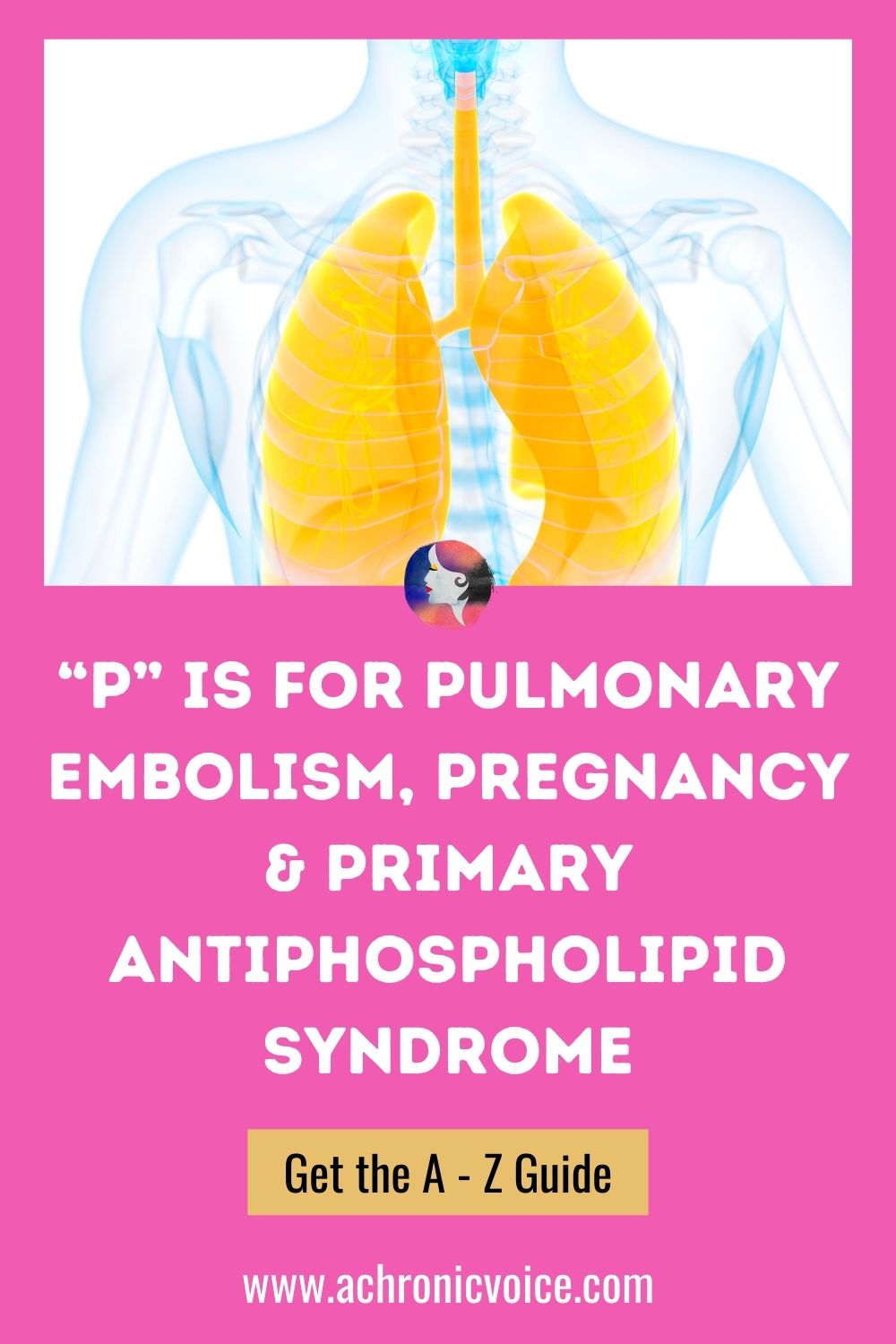P is for Pulmonary Embolism, Pregnancy and Primary Antiphospholipid Syndrome - Get the A to Z Guide.