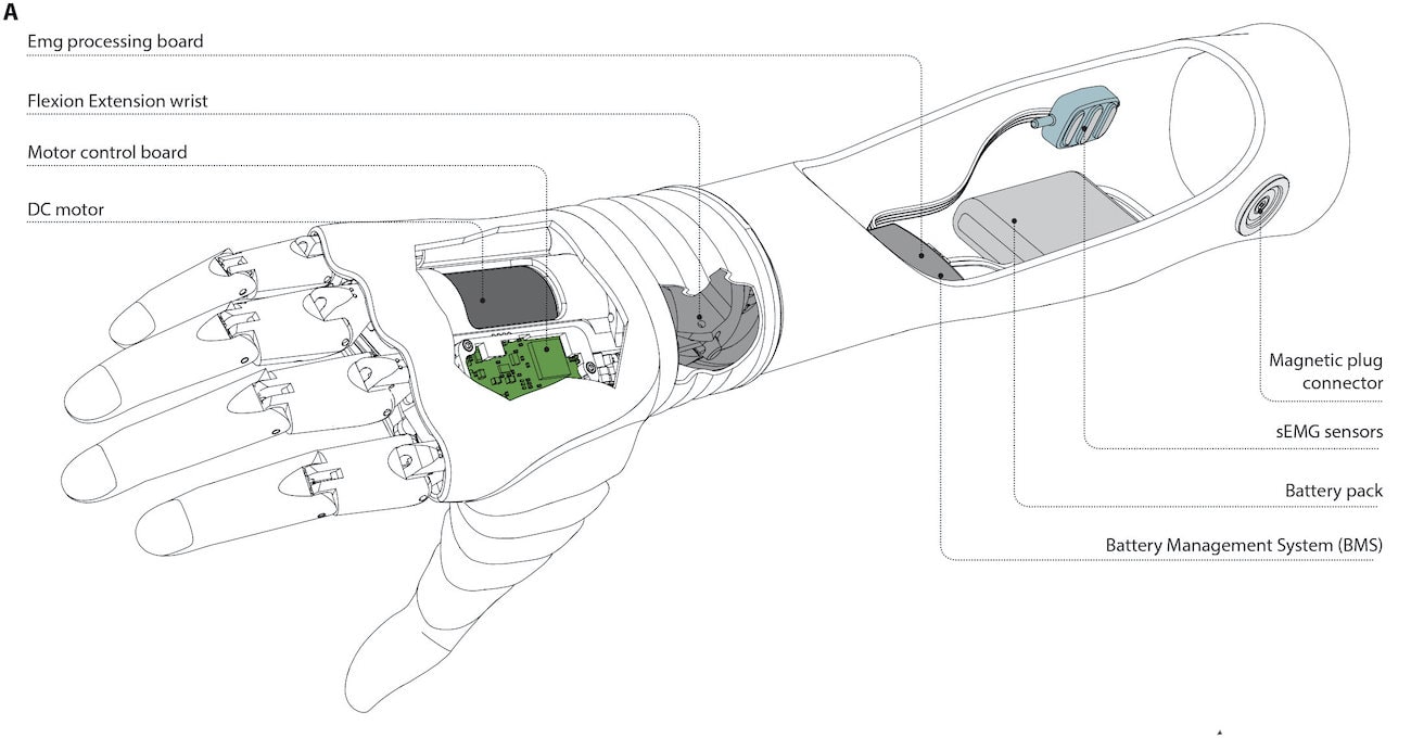 architecture prothese main robotique hannes schema