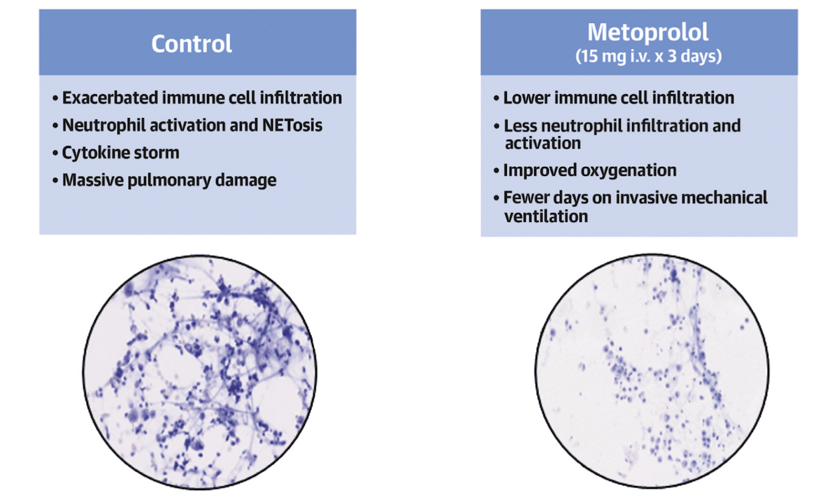 comparaison controle metoprolol degats poumons covid-19