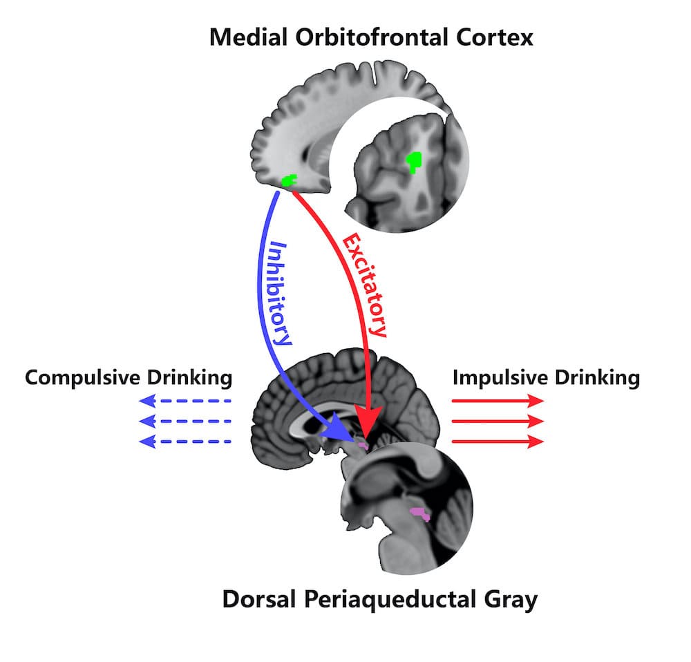 cortex orbitofrontal consommation abusive alcool