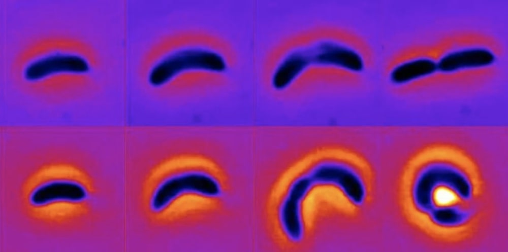 evolution forme bacterie avant apres exposition antibiotiques