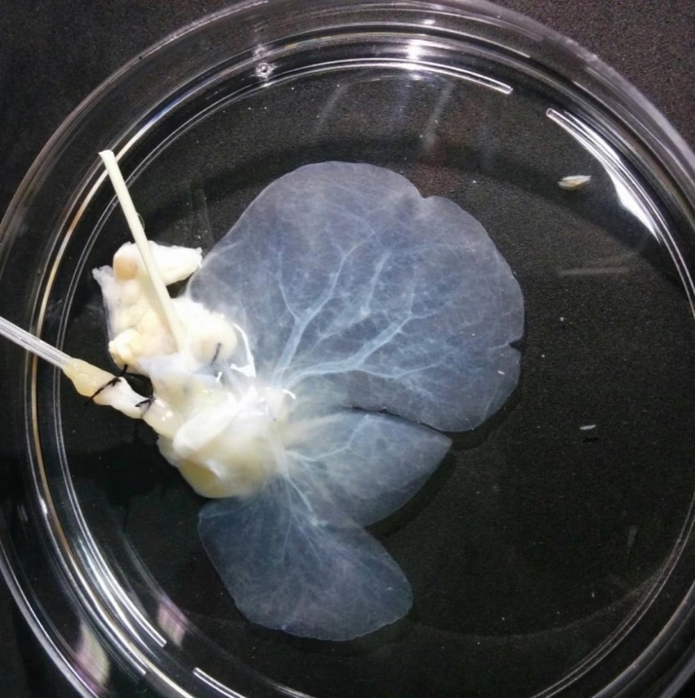 foie decellularise reconstruction foie humain