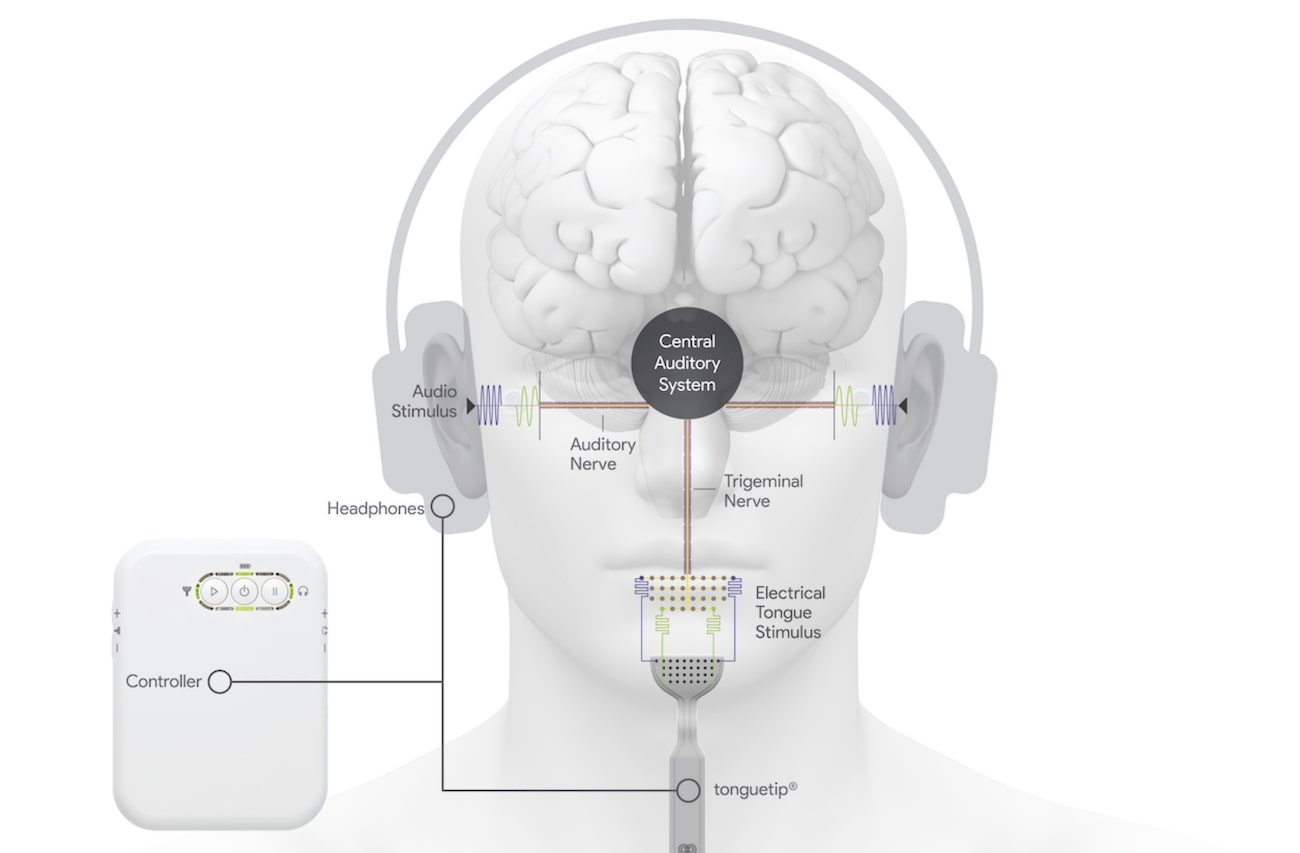 illustration fonctionnement lenire acouphenes