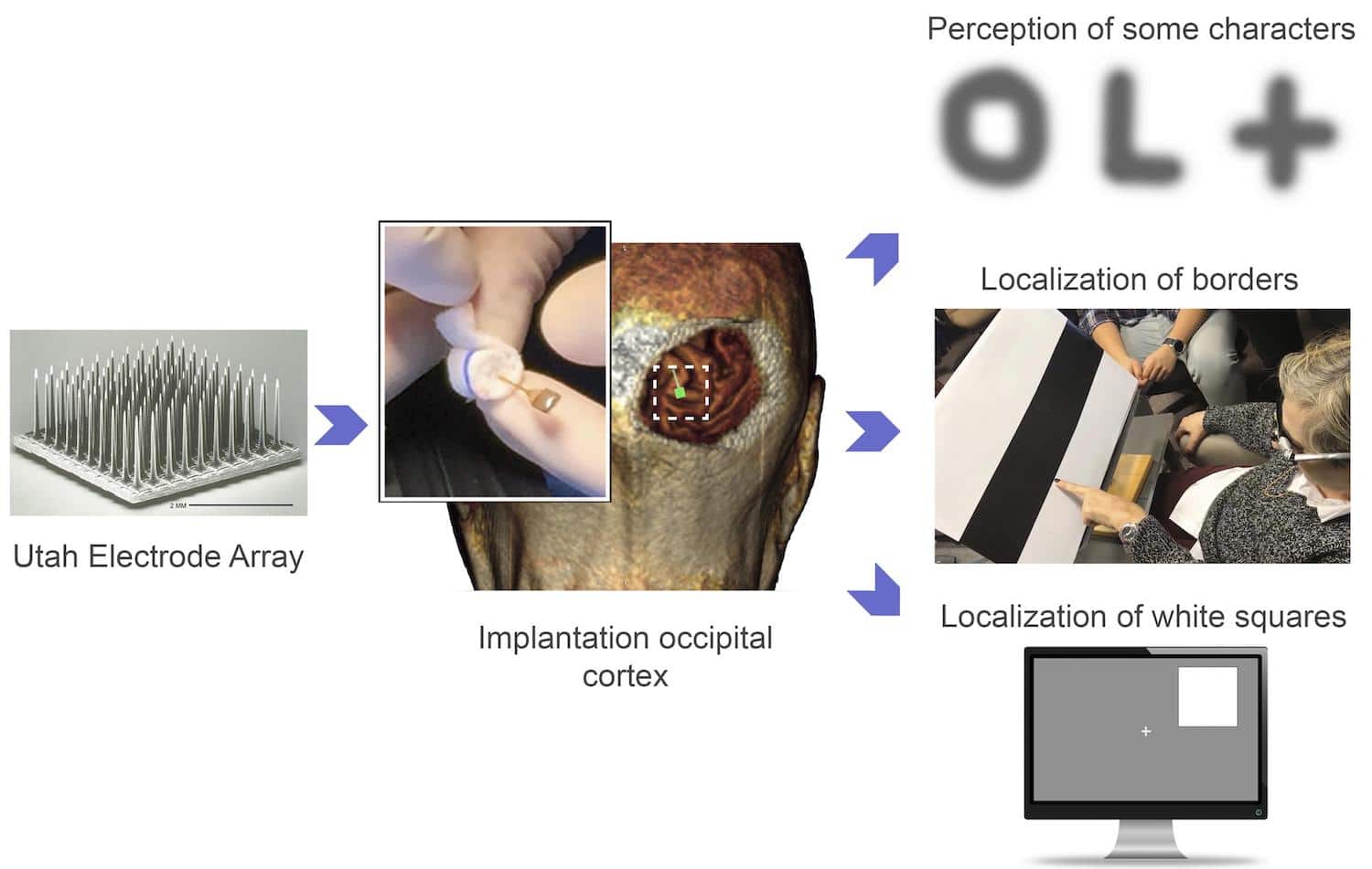 implant vision camera applications