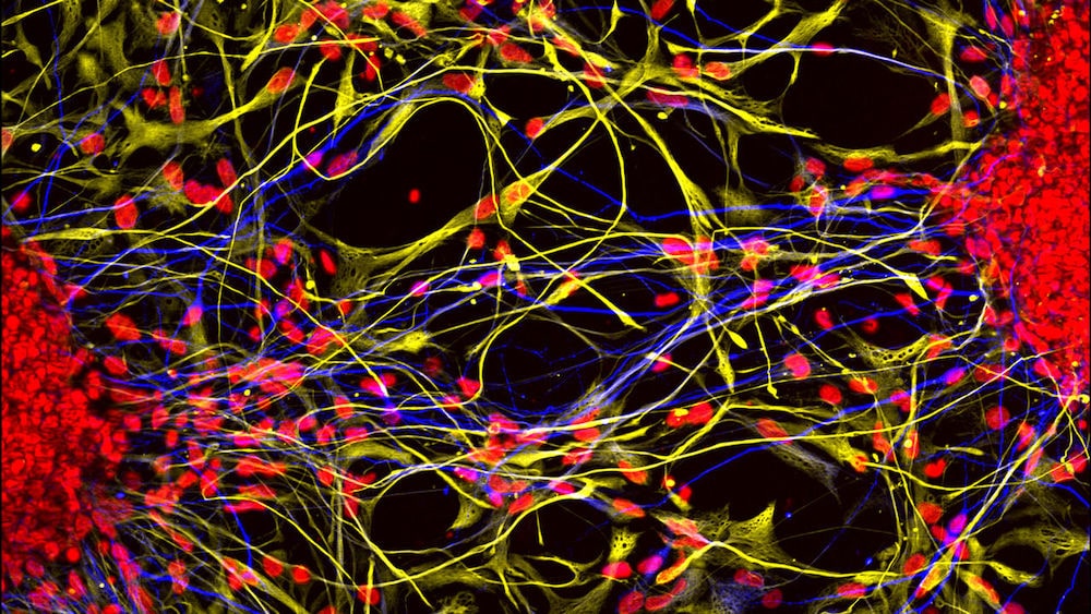 organoides cerebraux neurones astrocytes