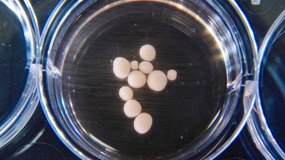 organoides porteurs gene neandertal