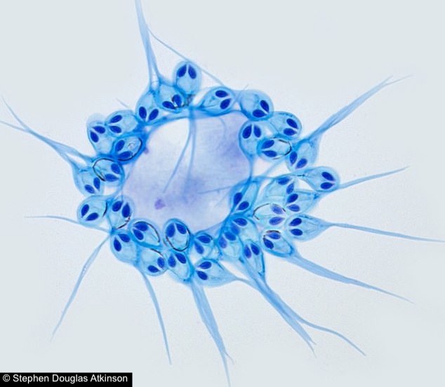 parasite survie sans oxygene henneguya salminicola