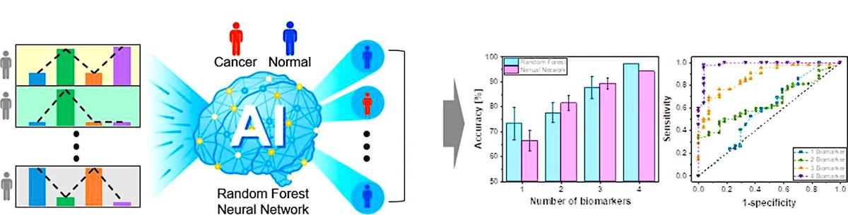 schema methode depistage cancer urine ia