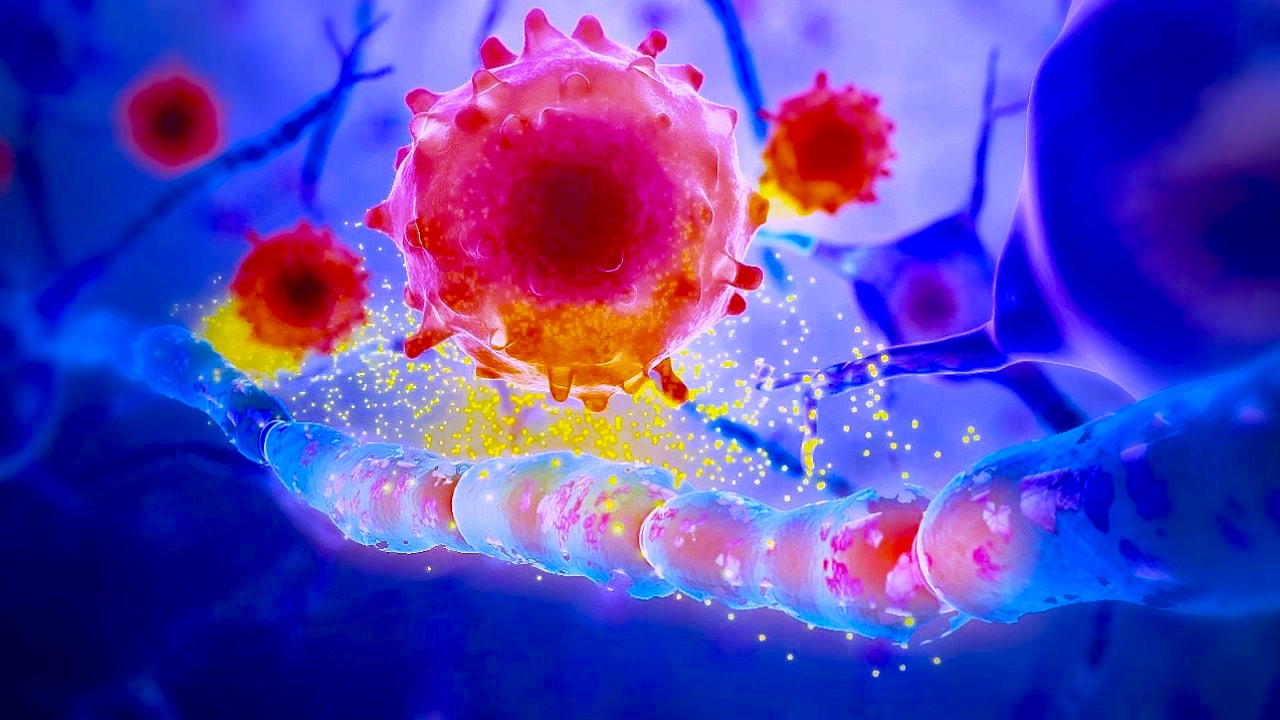 Sclerose en plaque auto antigene myeline