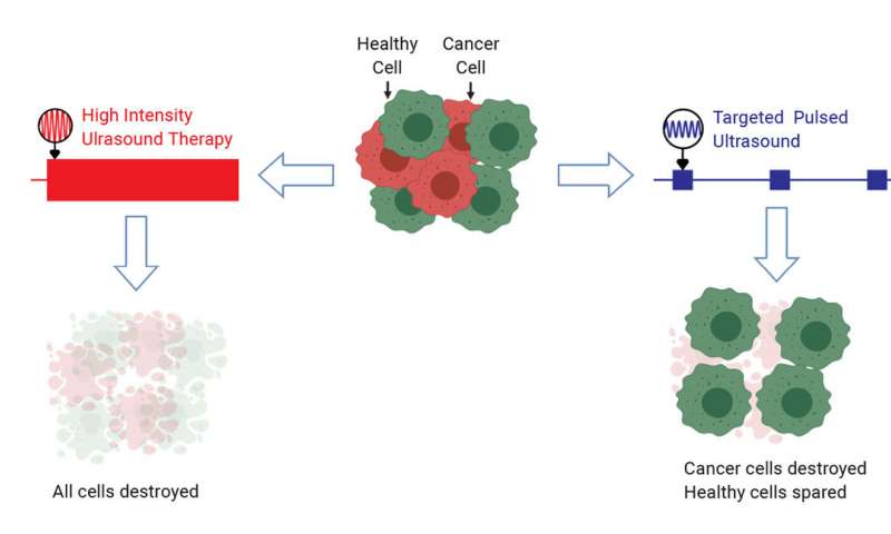 traitement cancer par ultrasons schema