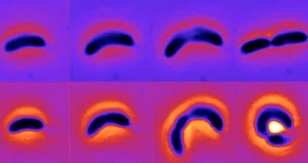Des bactéries observées en train de changer de forme pour échapper aux antibiotiques