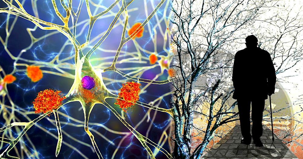 Alzheimer : des chercheurs identifient la cause de la progression agressive de la maladie