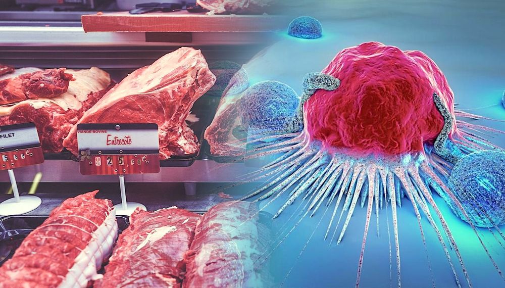 Découverte d'un lien moléculaire entre l'alimentation et le risque de cancer