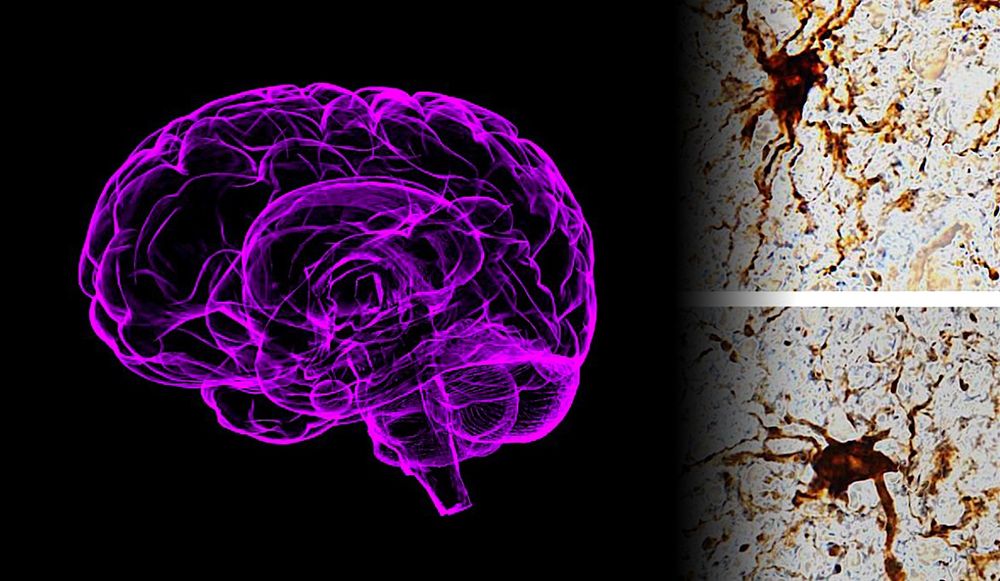 Une étude montre que certains gènes "reprennent vie" dans le cerveau après la mort