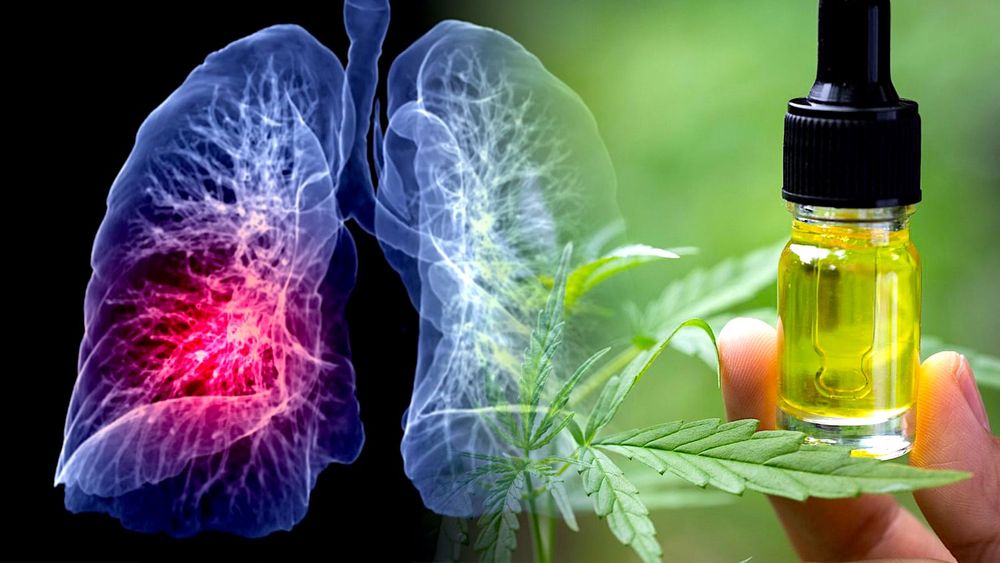 Une femme s'auto-traitant uniquement avec du CBD voit la taille de sa tumeur régresser de 76%