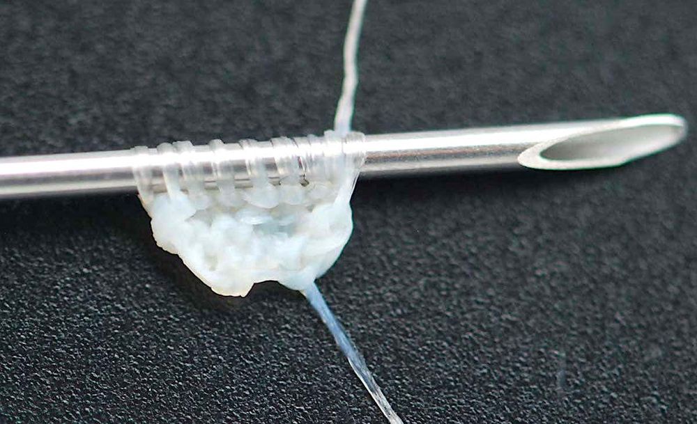 Ce fil issu de cellules de peau humaine pourrait être utilisé pour fabriquer du tissu de greffe implantable