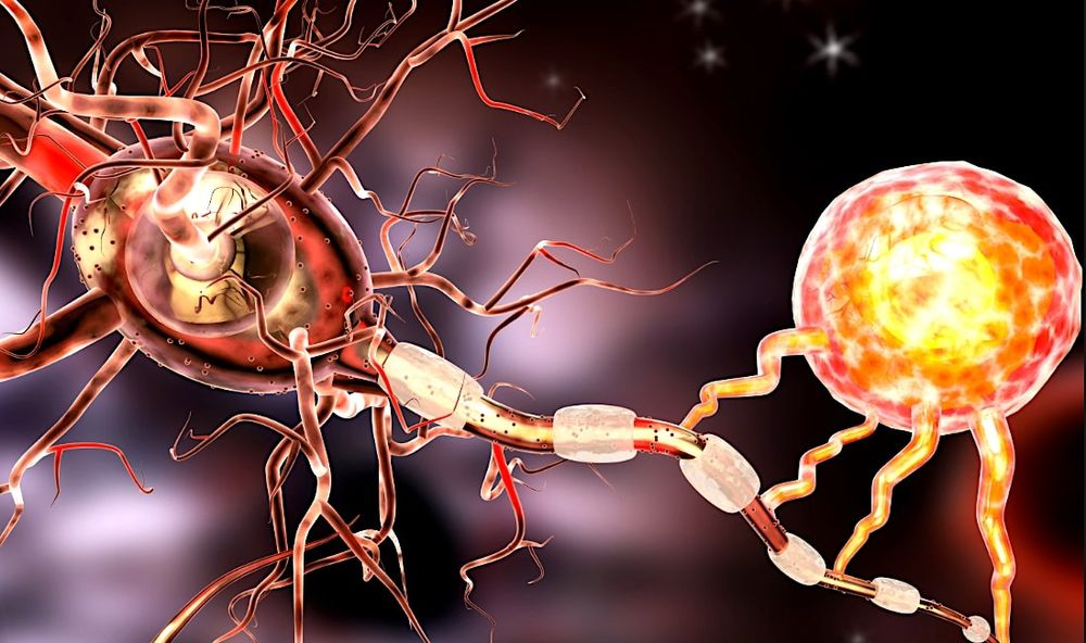 Innovation : un hydrogel conducteur qui pourrait guérir les lésions nerveuses