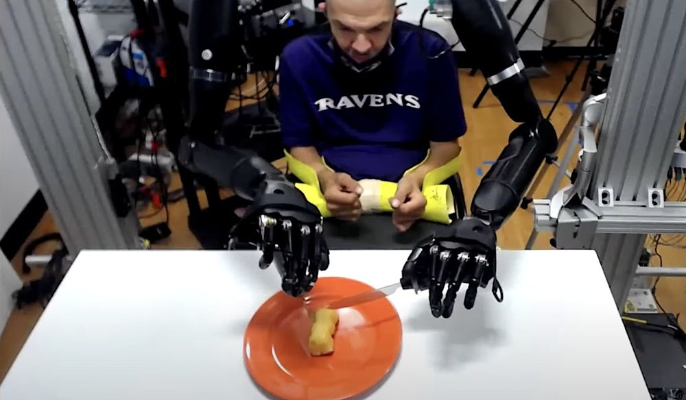 Un patient quadriplégique utilise deux bras prothétiques connectés au cerveau pour se nourrir (VIDÉO)