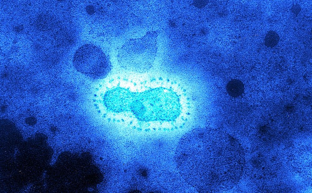 Des virus inconnus vieux de 15 000 ans découverts dans un glacier tibétain