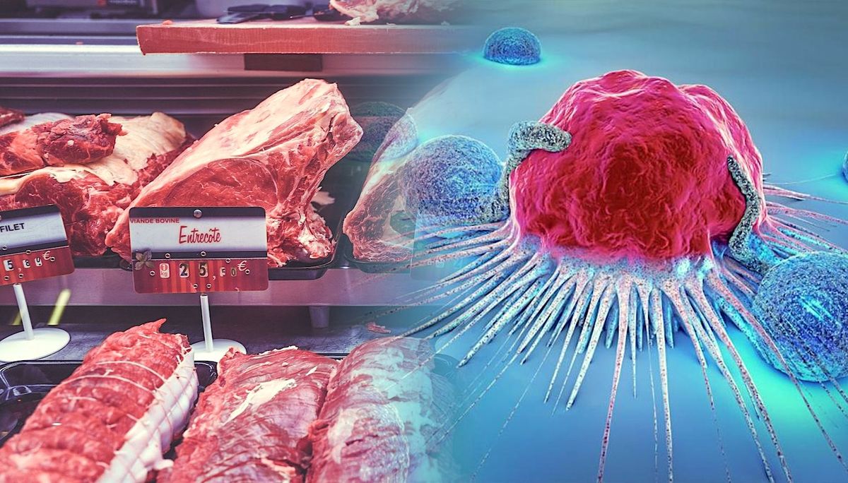 Découverte d'un lien moléculaire entre l'alimentation et le risque de cancer
