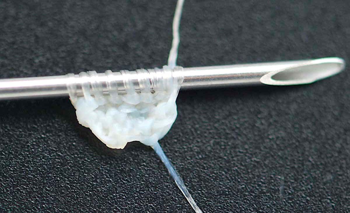 Ce fil issu de cellules de peau humaine pourrait être utilisé pour fabriquer du tissu de greffe implantable
