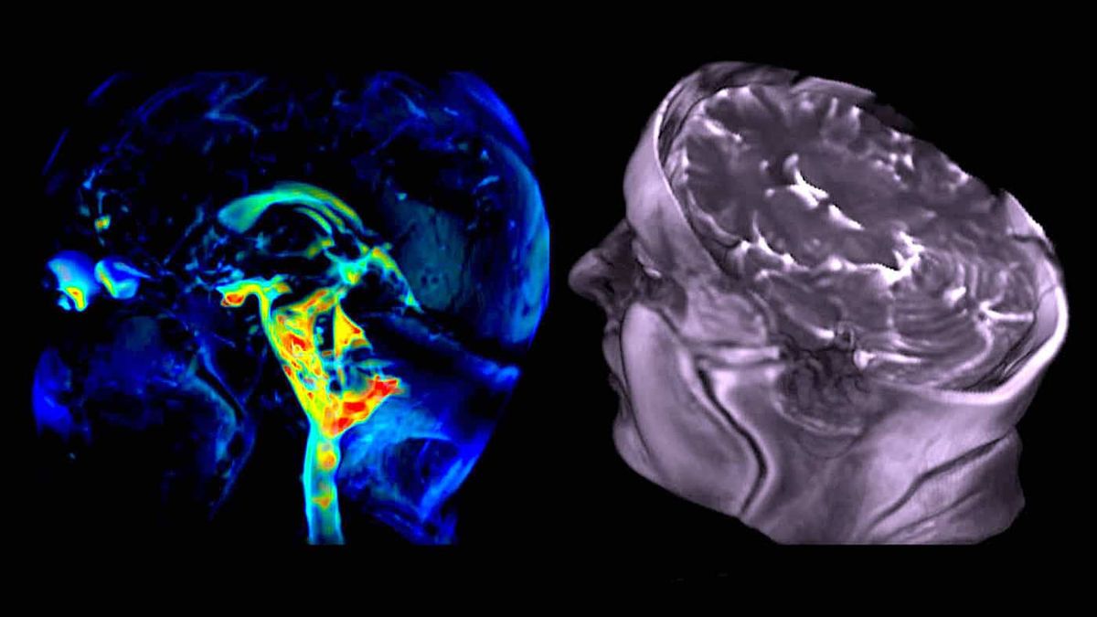 Une nouvelle technique d'imagerie capture le "mouvement cérébral" avec une précision étonnante (+VIDÉOS)