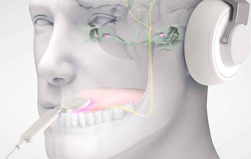 Acouphènes : un traitement à base de musique électronique et de stimulations de la langue