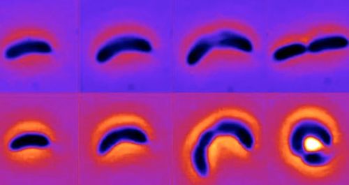 Des bactéries observées en train de changer de forme pour échapper aux antibiotiques