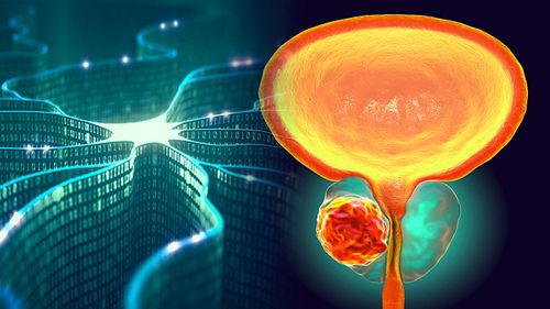 Diagnostiquer le cancer avec précision avec un test d'urine et une intelligence artificielle