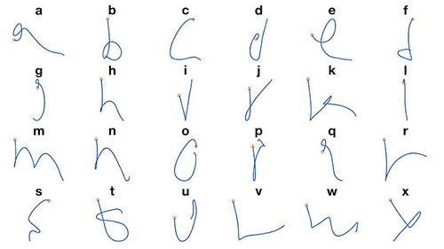 Une IA permet à des tétraplégiques d'écrire avec leur pensée, comme s'ils écrivaient à la main