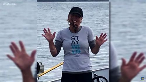 Une femme place une pieuvre sur son visage pour une photo : elle se fait mordre violemment et le regrette amèrement...