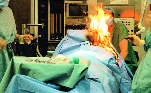 Une patiente brûlée vive lors d'une opération chirurgicale en Roumanie