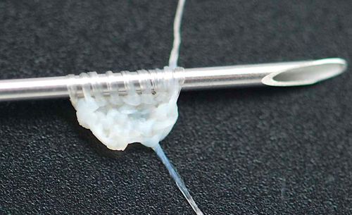 Ce fil issu de cellules de peau humaine pourrait être utilisé pour fabriquer du tissu de greffe implantable