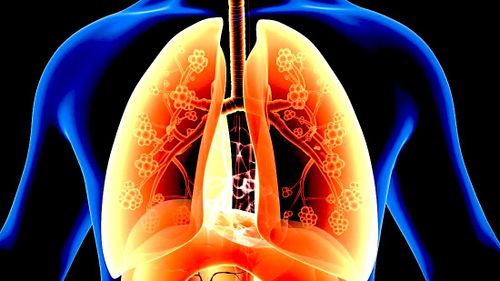 Découverte : la graisse peut obstruer les poumons et les voies respiratoires, et pas seulement le cœur