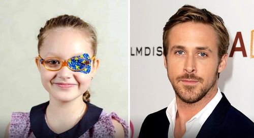 Un médicament antidépresseur permettrait de traiter « l'œil paresseux » chez l'adulte