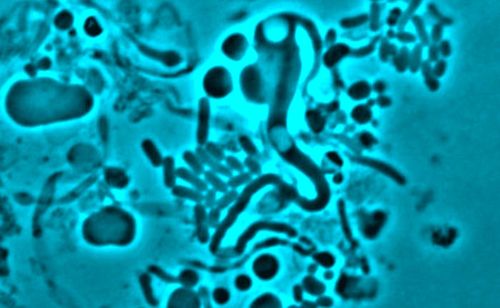 La potentielle et principale cause de la résistance aux antibiotiques des bactéries a été identifiée