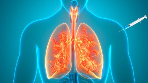 Un vaccin contre l'asthme développé par l'INSERM