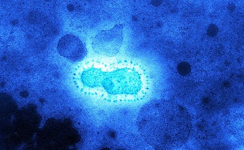 Des virus inconnus vieux de 15 000 ans découverts dans un glacier tibétain