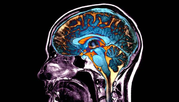 Les modifications cérébrales provoquées par la COVID auraient un impact sur la conscience et la cognition