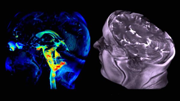 Une nouvelle technique d'imagerie capture le "mouvement cérébral" avec une précision étonnante (+VIDÉOS)
