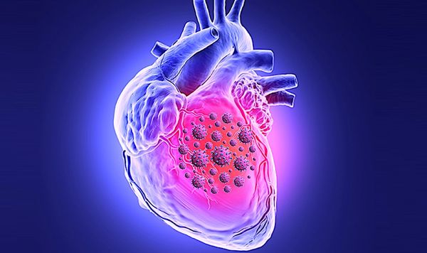 COVID : en tuant les cellules du muscle cardiaque, le coronavirus perturbe la contraction