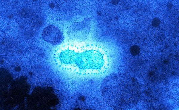 Des virus inconnus vieux de 15 000 ans découverts dans un glacier tibétain